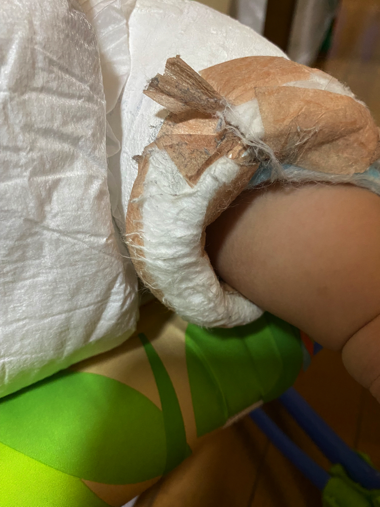 脱脂綿をマイクロポアテープで固定